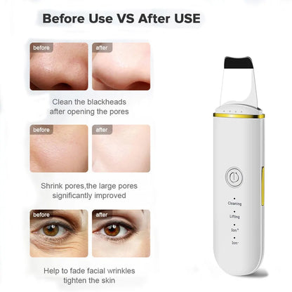 Beauty Ultrasonic Skin Scrubber